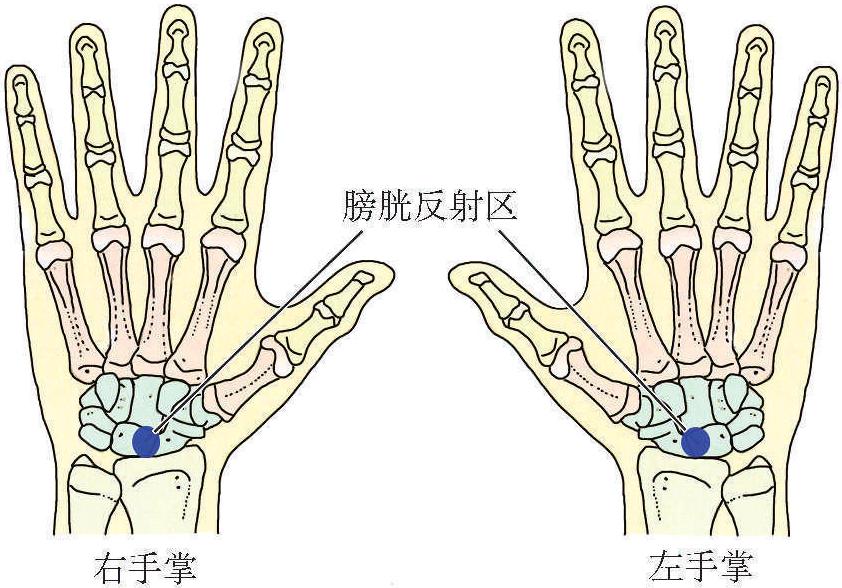 (七)膀胱炎